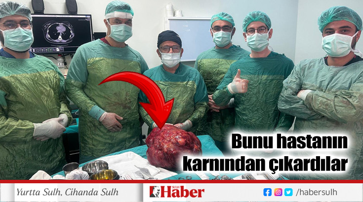 Midesi bulanan hastanın  karnından 13 kg kitle çıktı